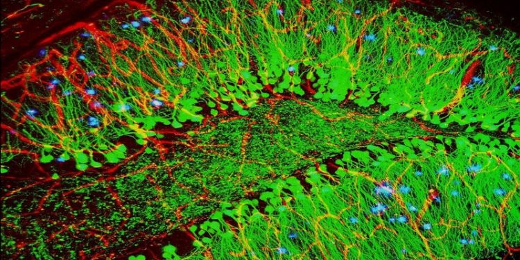 Un estudio con participación malagueña logra ver las alteraciones neuronales del Alzheimer en ratones 1 cerebro ratones alzheimer