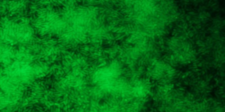 Científicos granadinos estudian el uso de una molécula para tanto estimular como evitar el desarrollo de bacterias 1 Biofilm Bacterias Microcospio